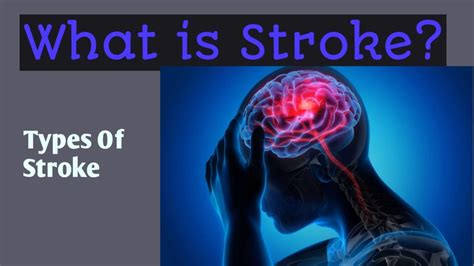 stroke trad|final stroke meaning in french.